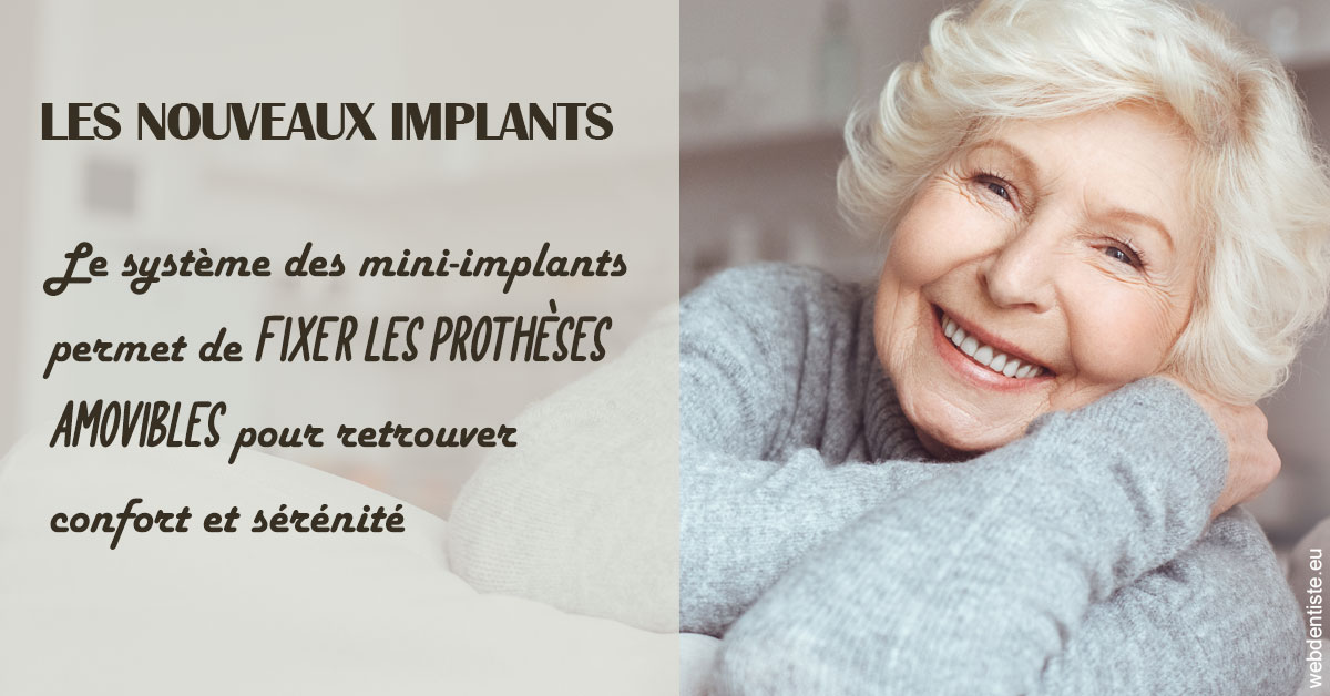 https://selarl-de-pape-romain.chirurgiens-dentistes.fr/Les nouveaux implants 1