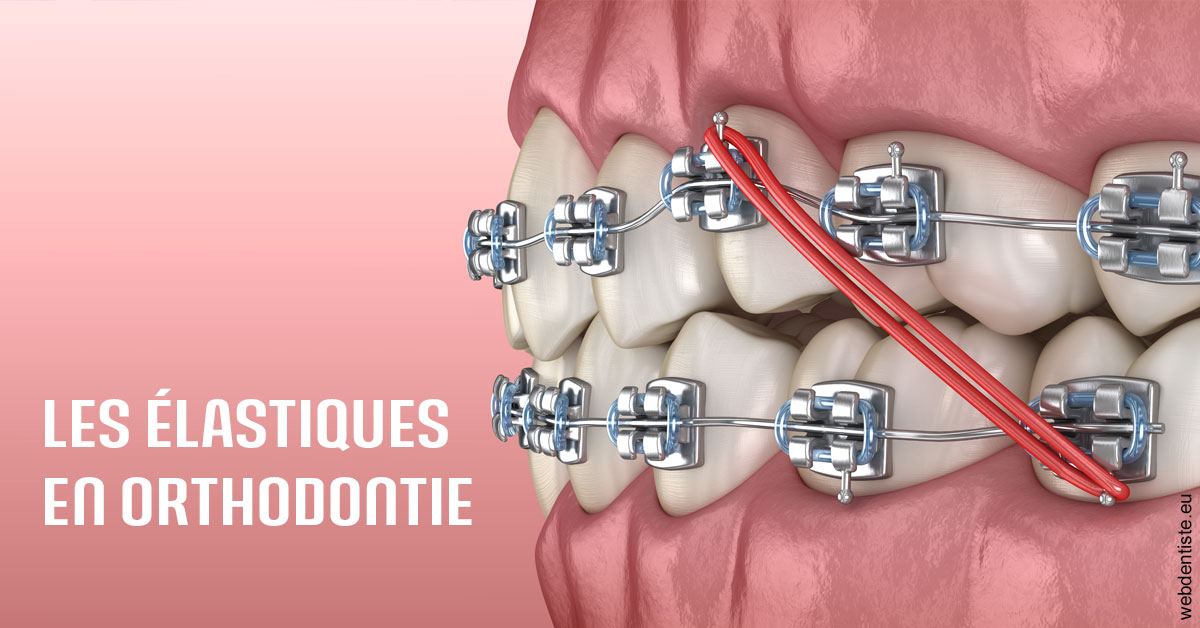 https://selarl-de-pape-romain.chirurgiens-dentistes.fr/Elastiques orthodontie 2
