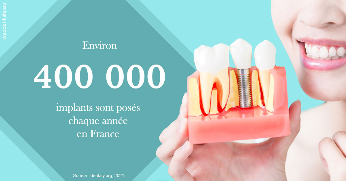 https://selarl-de-pape-romain.chirurgiens-dentistes.fr/Pose d'implants en France 2